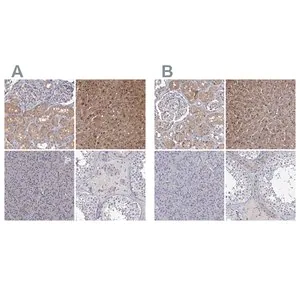 Merck Anti-GSTO1 antibody produced in rabbit