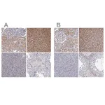 Merck Anti-GSTO1 antibody produced in rabbit
