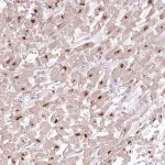 Merck Anti-RBM20 antibody produced in rabbit
