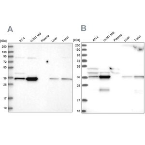 Merck Anti-GPATCH11 antibody produced in rabbit
