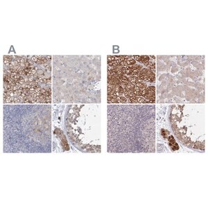 Merck Anti-AAMDC antibody produced in rabbit