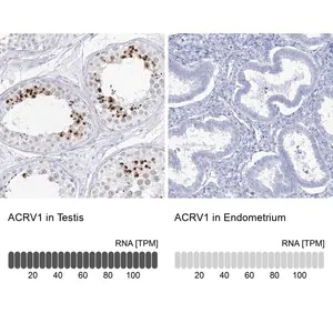 Merck Anti-ACRV1 antibody produced in rabbit
