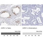 Merck Anti-ACRV1 antibody produced in rabbit
