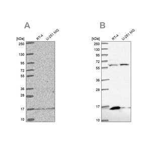 Merck Anti-MRPS16 antibody produced in rabbit