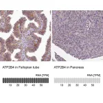 Merck Anti-ATP2B4 antibody produced in rabbit