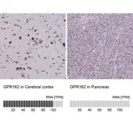Merck Anti-GPR162 antibody produced in rabbit