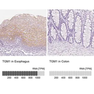 Merck Anti-TGM1 antibody produced in rabbit