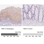 Merck Anti-TGM1 antibody produced in rabbit