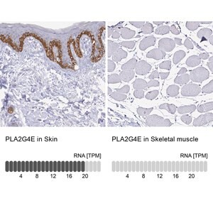 Merck Anti-PLA2G4E antibody produced in rabbit
