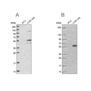Merck Anti-ACSBG1 antibody produced in rabbit