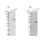 Merck Anti-ACSBG1 antibody produced in rabbit