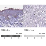 Merck Anti-NOD2 antibody produced in rabbit