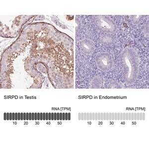 Merck Anti-SIRPD antibody produced in rabbit