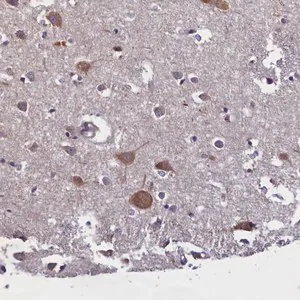 Merck Anti-ABCC8 antibody produced in rabbit