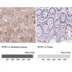 Merck Anti-RYR1 antibody produced in rabbit