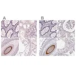 Merck Anti-KRT82 antibody produced in rabbit