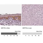 Merck Anti-KRT79 antibody produced in rabbit