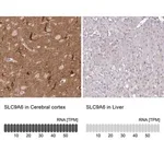 Merck Anti-SLC9A6 antibody produced in rabbit