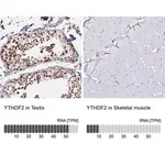 Merck Anti-YTHDF2 antibody produced in rabbit