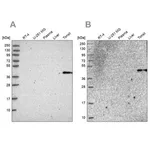 Merck Anti-SULT2B1 antibody produced in rabbit
