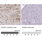 Merck Anti-CCSAP antibody produced in rabbit