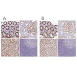 Merck Anti-A1CF antibody produced in rabbit