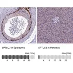 Merck Anti-SPTLC3 antibody produced in rabbit