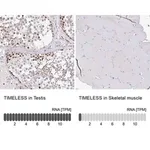 Merck Anti-TIMELESS antibody produced in rabbit