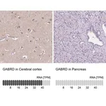 Merck Anti-GABRD antibody produced in rabbit