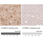 Merck Anti-CTTNBP2 antibody produced in rabbit