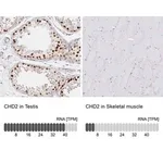 Merck Anti-CHD2 antibody produced in rabbit