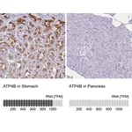 Merck Anti-ATP4B antibody produced in rabbit