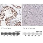 Merck Anti-TRIP12 antibody produced in rabbit