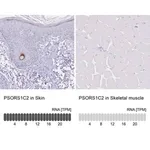 Merck Anti-PSORS1C2 antibody produced in rabbit