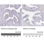 Merck Anti-AKAP14 antibody produced in rabbit
