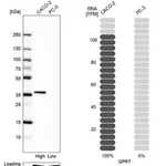 Merck Anti-QPRT antibody produced in rabbit