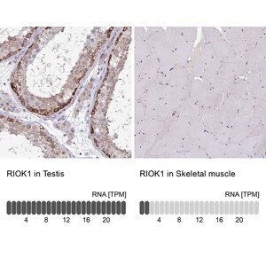Merck Anti-RIOK1 antibody produced in rabbit