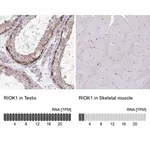 Merck Anti-RIOK1 antibody produced in rabbit