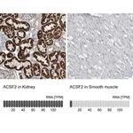 Merck Anti-ACSF2 antibody produced in rabbit