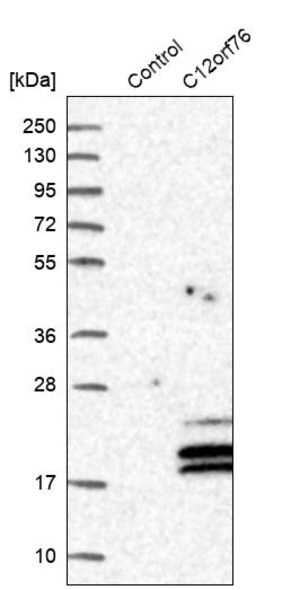 Merck Anti-C12orf76 antibody produced in rabbit