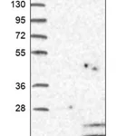 Merck Anti-C12orf76 antibody produced in rabbit