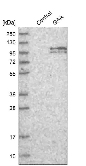 Merck Anti-GAA antibody produced in rabbit