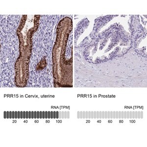 Merck Anti-PRR15 antibody produced in rabbit