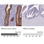 Merck Anti-PRR15 antibody produced in rabbit
