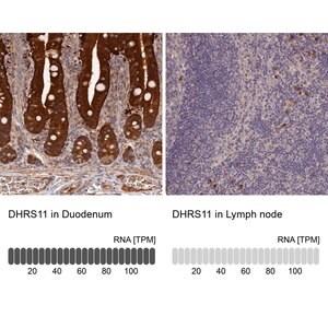 Merck Anti-DHRS11 antibody produced in rabbit
