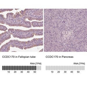 Merck Anti-CCDC170 antibody produced in rabbit