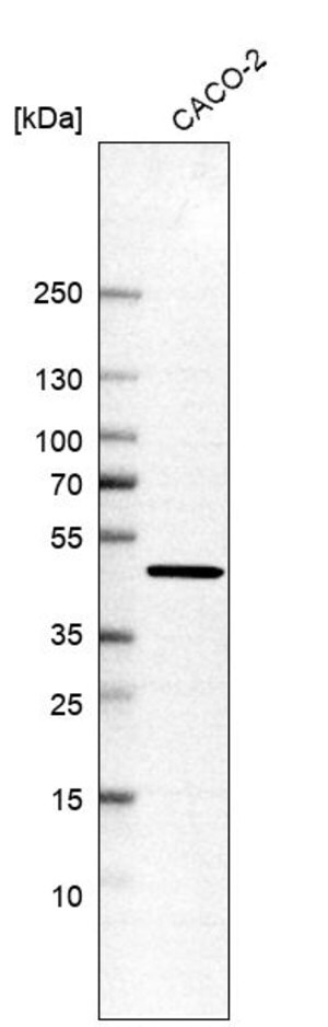 Merck Anti-AHCY antibody produced in rabbit
