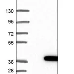 Merck Anti-MMACHC antibody produced in rabbit
