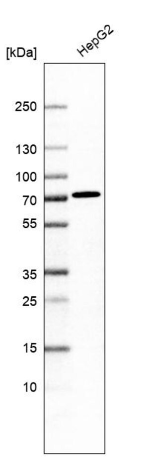 Merck Anti-ACSS3 antibody produced in rabbit