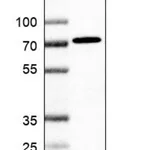 Merck Anti-ACSS3 antibody produced in rabbit